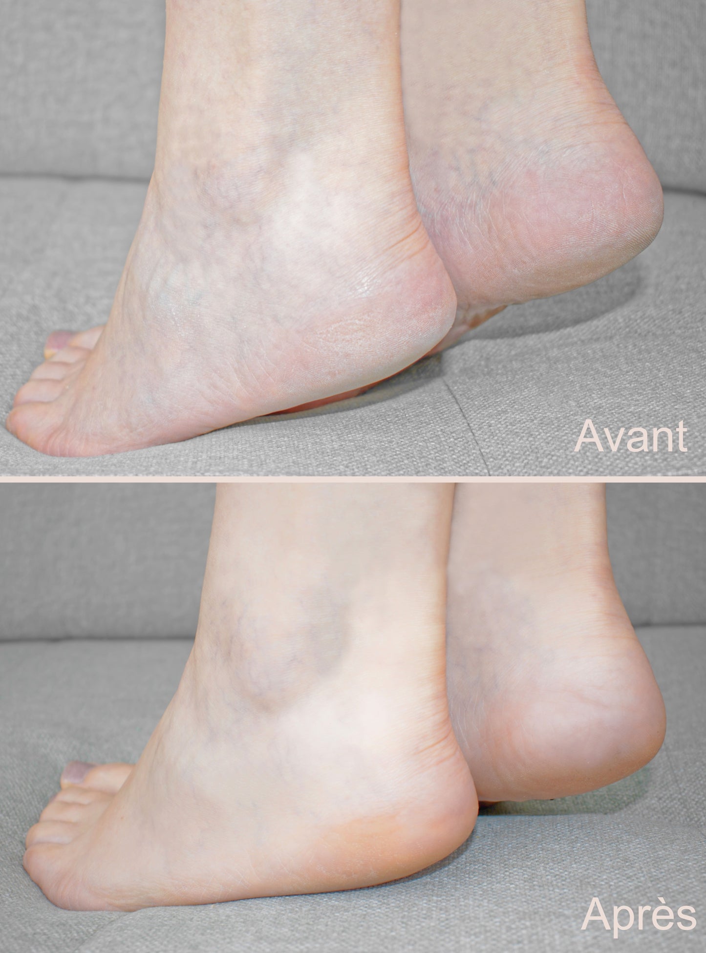 Râpe électrique pédicure VINTURAA – 60 disques abrasifs | Pieds doux en 5 min