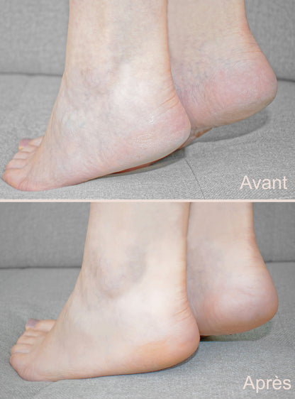 Râpe électrique pédicure VINTURAA – 60 disques abrasifs | Pieds doux en 5 min